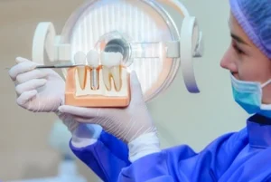 Stages of Dental Implants procedure