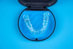 Invisalign Vs veneers orthodontic aligners Invisalign Vs veneers orthodontic aligners