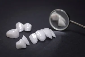 veneer shells lined up with a dental mirror veneer shells lined up with a dental mirror