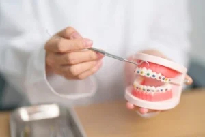 dental braces as orthodontic option on consultation